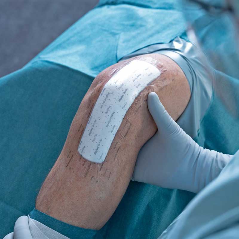 Mepilex Border Post-Op Dressing | Pack - Image 6