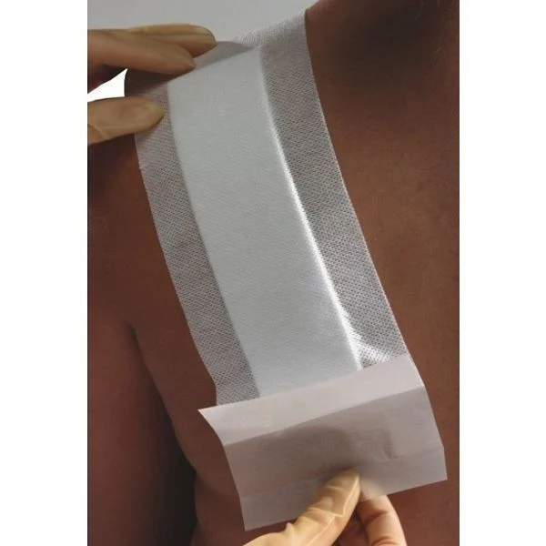 Primapore and Melolin Adhesive Island Dressing | Pack - Image 9